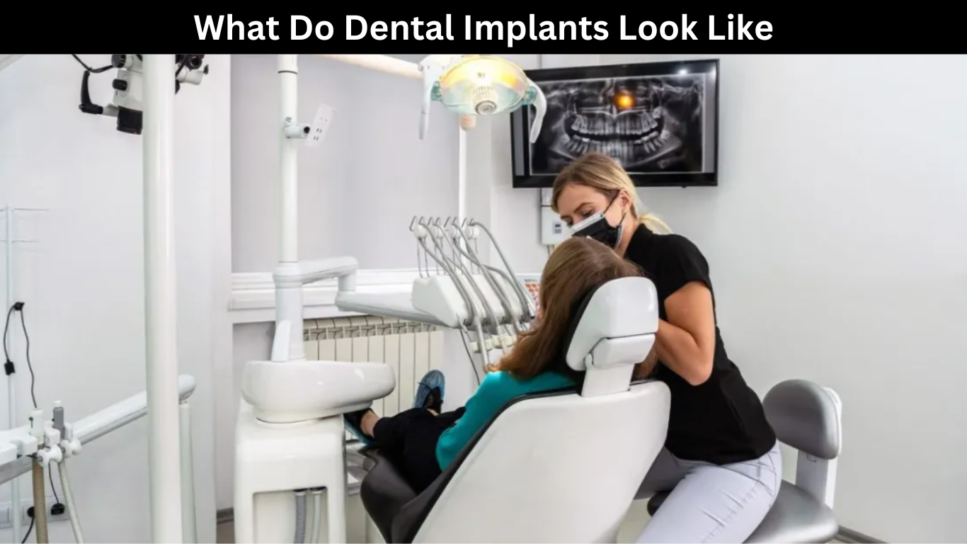 what do dental implants look like